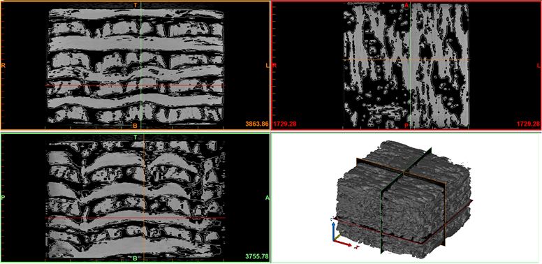 Three dimensional reconstruction of fiber bundle profile